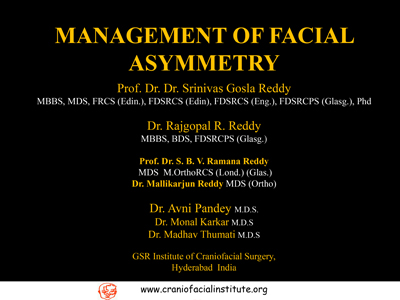 Management-of-facial-assymetry