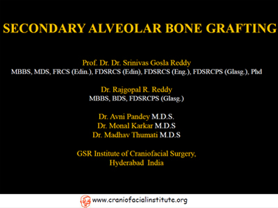 Secondary-alveolar-bone-grafting