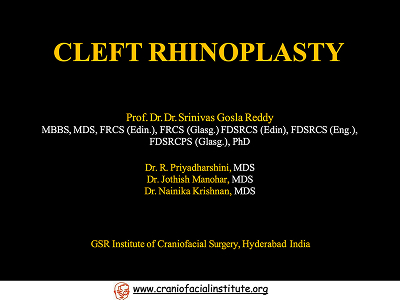 Cleft Rhinoplasty