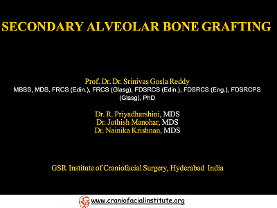 Secondary-alveolar-bone-grafting